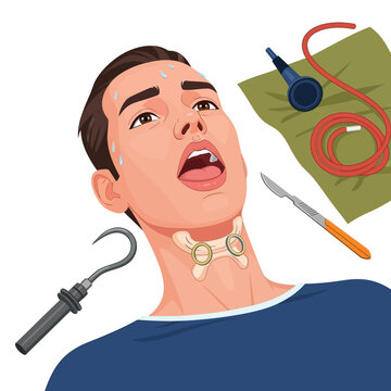 Medical illustration of a man undergoing a thyroidectomy with surgical tools, use this for healthcare, education, or training about thyroid surgery