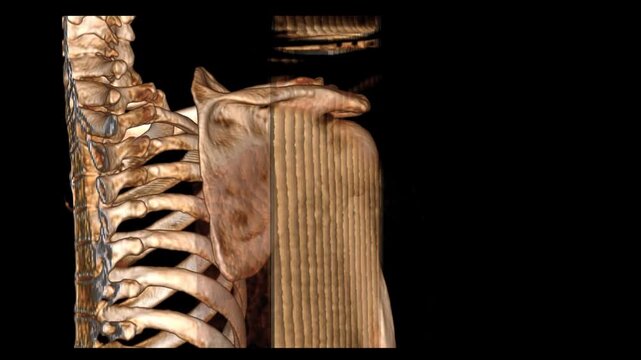 High-resolution VR movie of the right shoulder with thin plain soft tissue imaging, providing detailed visualization of muscles, tendons, ligaments, and joint structures.
