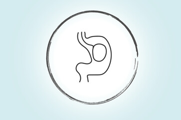 Intragastric balloon surgery is a non-surgical weight loss procedure in which a soft balloon is placed in the stomach to reduce its capacity and help patients feel full sooner