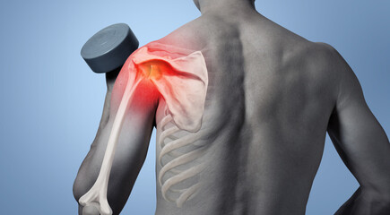 shoulder joint pain