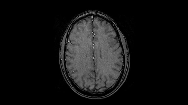 Human brain x ray men skull