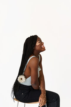 Self love with vitiligo