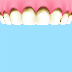 Upper teeth (Decay) - Text box banner (square) illustration vector design. Dental care concept.