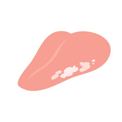 フチが白くなっている舌