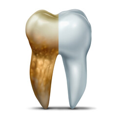 Yellow Teeth And White Tooth as Dental Plaque and yellowish buildup on teeth caused by hardened tartar as a sticky film of bacteria as a symbol of oral health dentist and dentistry or Tooth bacterial 