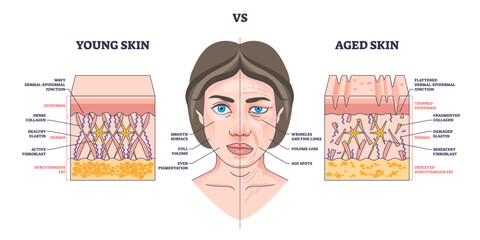 Young vs aged skin shows differences in collagen, elasticity, and wrinkles with labeled skin layers, transparent background.