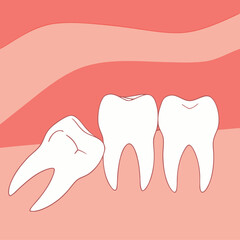 Wisdom tooth. Wisdoms teeth dental problem, gum pain, remove teeths dentist.oral health, toothache. Flat vector illustration

