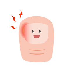 Ingrown Toenail on Foot. vector illustration