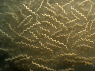  Lyme disease spirochetes floating in a liquid. Microscopic photo of a spirochete of Lyme disease bacteria