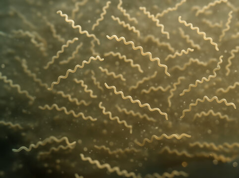  Lyme disease spirochetes floating in a liquid. Microscopic photo of a spirochete of Lyme disease bacteria