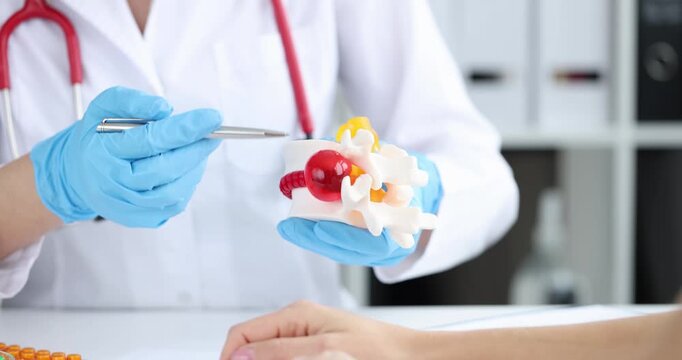 Doctor shows detailed anatomical model of spinal disc. Experienced physician explains mechanism of hernia formation during consultation at appointment