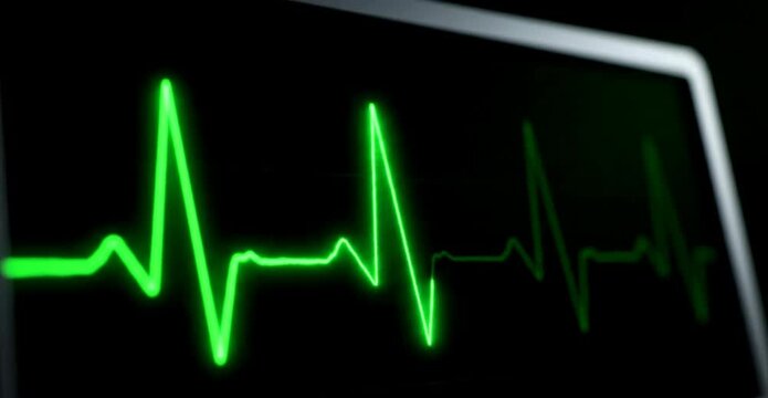 Green Electrocardiogram (ECG) Waveform on Black Background Representing Cardiac Cycle and Heart Monitoring