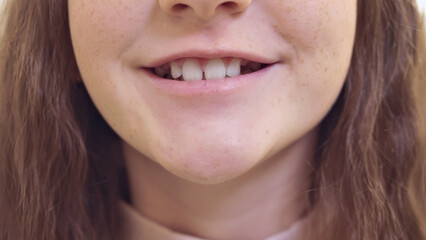Close-up of a smiling woman's mouth with healthy teeth and gums. Long brown hair frames her face.