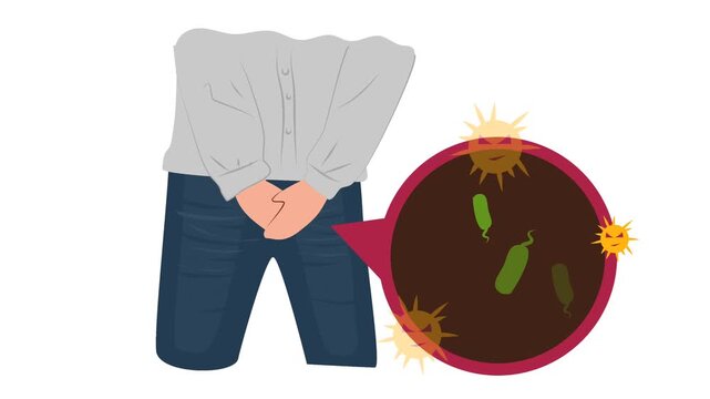 Human Urinary Bladder Disease and Infection Medical Illustration. Urology Health : Overactive Bladder (OAB) and Urinary Tract Inflammation Graphic Animation