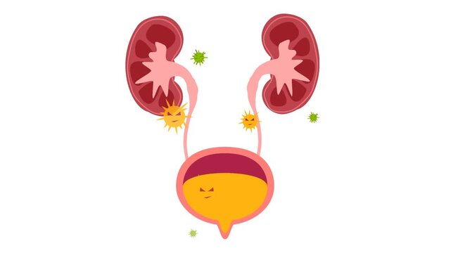 Human Urinary Bladder Disease and Infection Medical Illustration. Urology Health : Overactive Bladder (OAB) and Urinary Tract Inflammation Graphic Animation