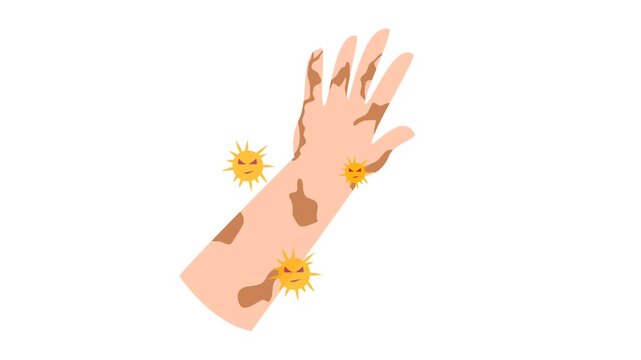 Leprosy disease illustration animation 