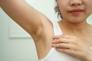 Naklejka premium Asian woman have problem black armpit beauty skin care.