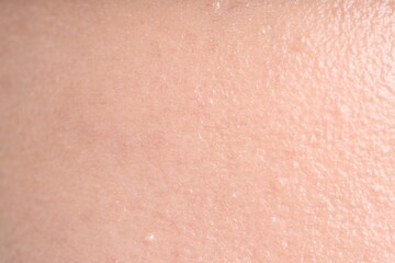 Fototapeta premium Texture of normal skin as background, closeup