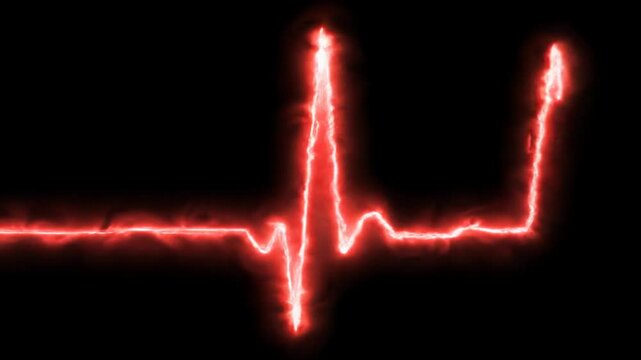 A vibrant, glowing, neon-red ECG line with distinct P, QRS, T waves scrolls, pulsing against a deep black void. Simulates real-time medical monitor. High-tech monitoring concept