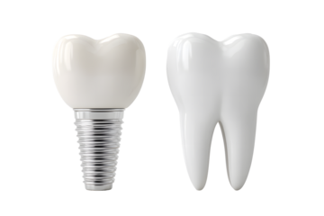 Stunning dental implant and natural tooth comparison showcasing modern oral healthcare solutions for healthy smiles