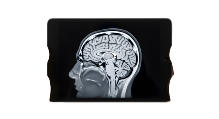Detailed MRI scan of a human brain in profile showcasing intricate neural structures.