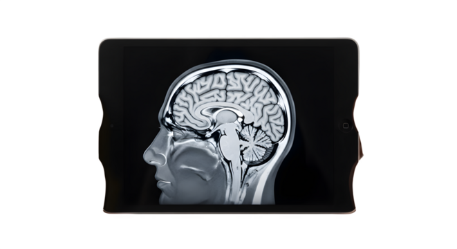 Detailed MRI scan of a human brain in profile showcasing intricate neural structures.