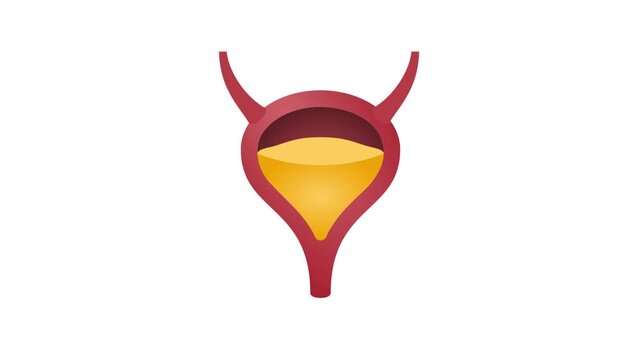 Human Urinary Bladder Full of Yellow Urine