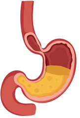 Human Stomach Full with Gastric Acid Liquid Illustration Isolated on White Background