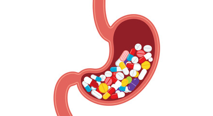 A graphic representation of a stomach filled with numerous colorful pills and capsules.