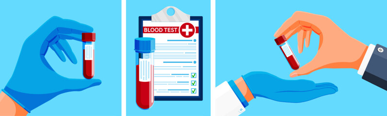 A set of three flat illustrations depicting medical blood test procedures and results. Health diagnostics and laboratory examination concept.