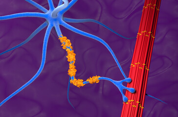 Guillain–Barre syndrome (GBS) - isometric view 3d illustration