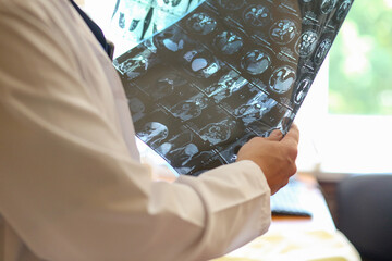 Doctor holding and examining MRI or CT scan images with human organs in light. Concept of medical diagnostics, radiology, examination and health research.