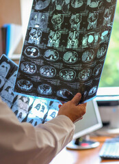 Doctor holding and examining MRI or CT scan images with human organs in light. Concept of medical diagnostics, radiology, examination and health research.