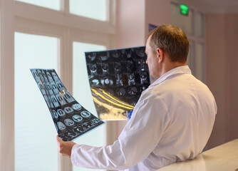 Doctor holding and examining MRI or CT scan images with human organs in light. Concept of medical diagnostics, radiology, examination and health research.