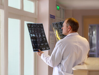 Doctor holding and examining MRI or CT scan images with human organs in light. Concept of medical diagnostics, radiology, examination and health research.
