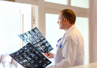 Doctor holding and examining MRI or CT scan images with human organs in light. Concept of medical diagnostics, radiology, examination and health research.
