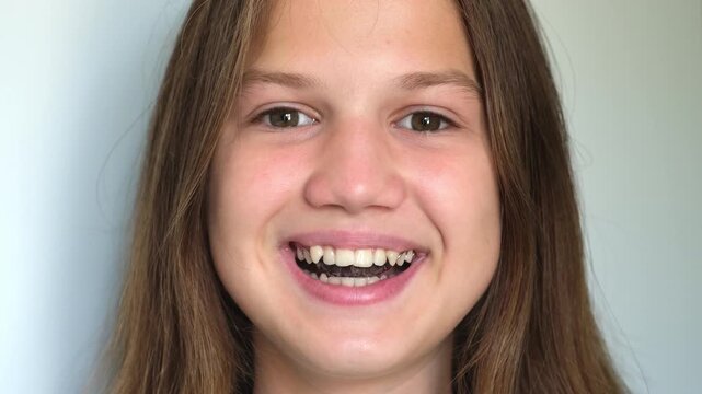 Teenage girl smiling in orthodontic apparatus for correcting the upper jaw. Device for dental treatment. Teeth correction, gnathology concept