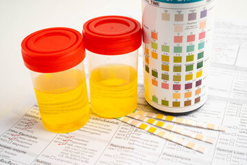 Urinalysis, urine cup with reagent strip pH paper test and comparison chart in laboratory.