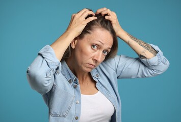 Worried woman with hair loss problem on light blue background