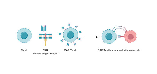 CAR T-cell therapy, killing of tumor cells. Cancer therapy. Chimeric antigen receptor T cell ,CAR T cell, for use in immunotherapy. Genetic engineering. Chemotherapy. Vector illustration.