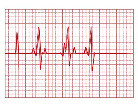 Medical ECG graphic with red waveforms