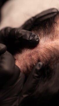 Process of scalp micropigmentation (SMP) for restoring the look of a fuller head of hair and defining a natural hairline