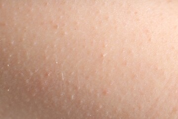 Fototapeta premium Texture of normal skin as background, closeup