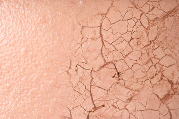 Dry skin presented as double exposure with cracked soil