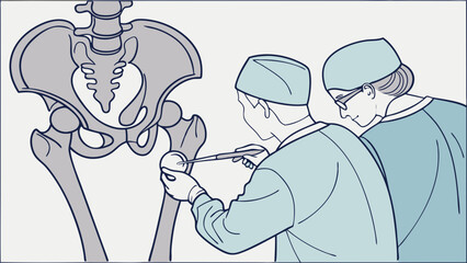 Medical Illustration Surgeons Examining Hip Joint Orthopedic Surgery Bone Diagram Healthcare Line Art.