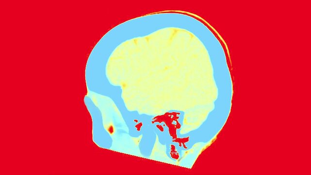 MRI Scan of the Human Brain Featuring Distinctive Color Patterns in a Transverse View with Emphasis on Anatomical Structures
