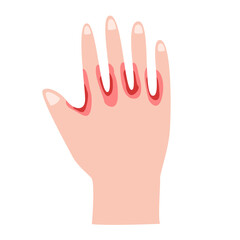 Athlete's Foot disease concept