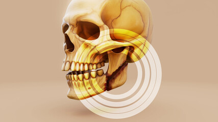 Conceptual 3D illustration of a jaw fracture