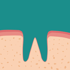 치과 치아치료 tooth treatment