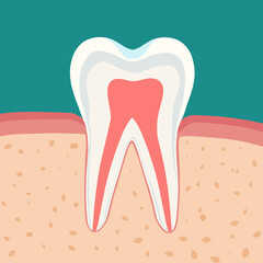 치아 신경치료와 충치치료 tooth root canal treatment